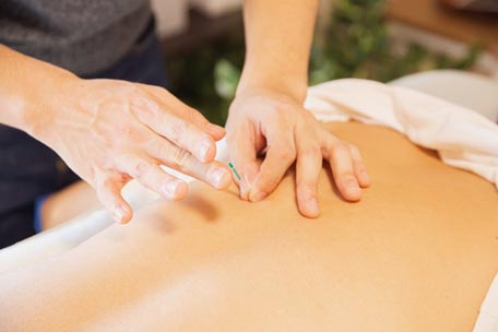 Acupuncture – More Than Just Pins And Needles